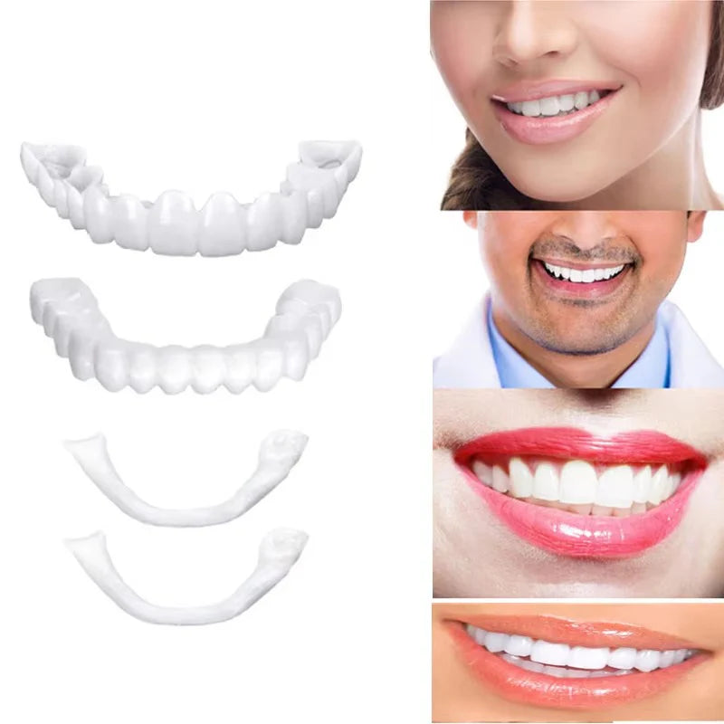 Snap on Smile Teeth Whitening veneers
