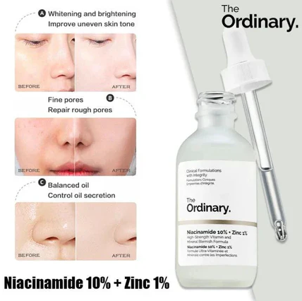 π₯ The Ordinary Niacinamide 10% + Zinc 1% Serum β Supersize 30ml | Oil Control & Skin Brightening Formula π