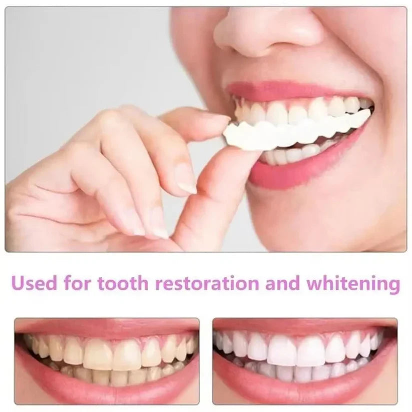 Snap on Smile Teeth Whitening veneers