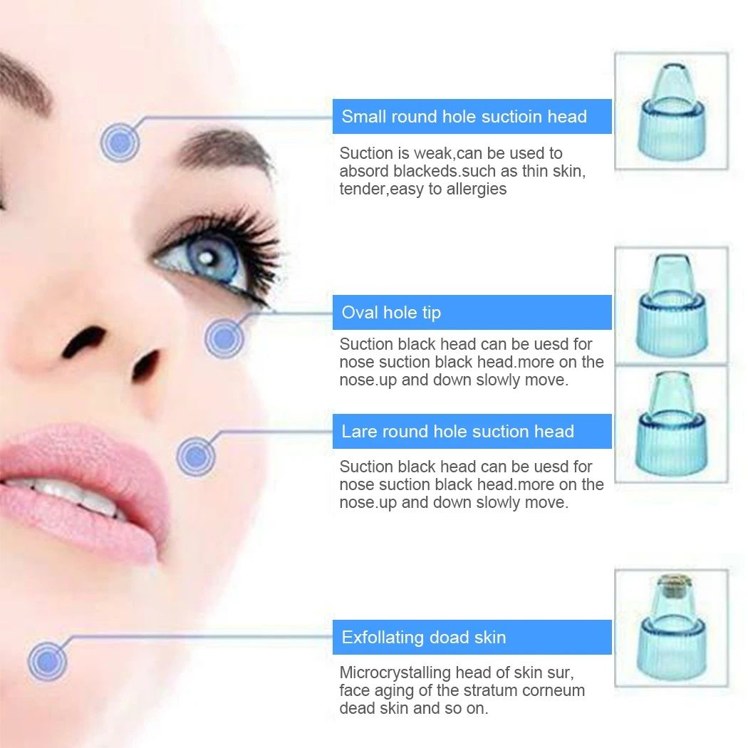 4-in-1 Derma Suction Blackhead Remover | Portable Pore Vacuum