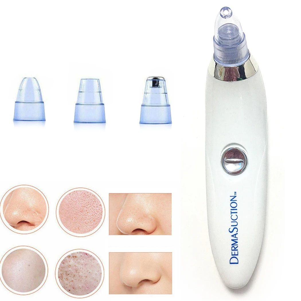 4-in-1 Derma Suction Blackhead Remover | Portable Pore Vacuum