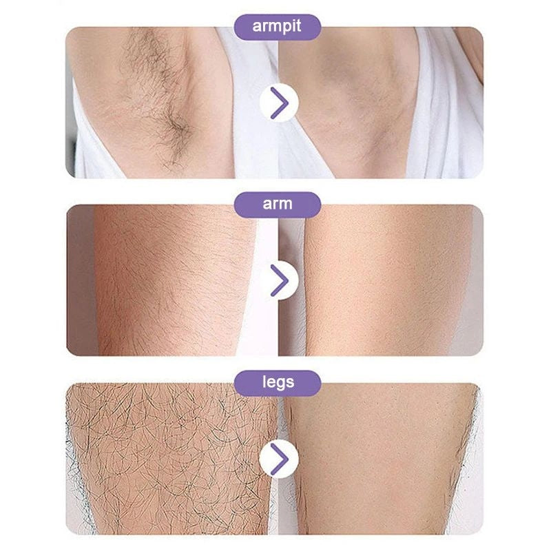 Crystal Hair Remover – Painless Full Body Epilator for Men & Women