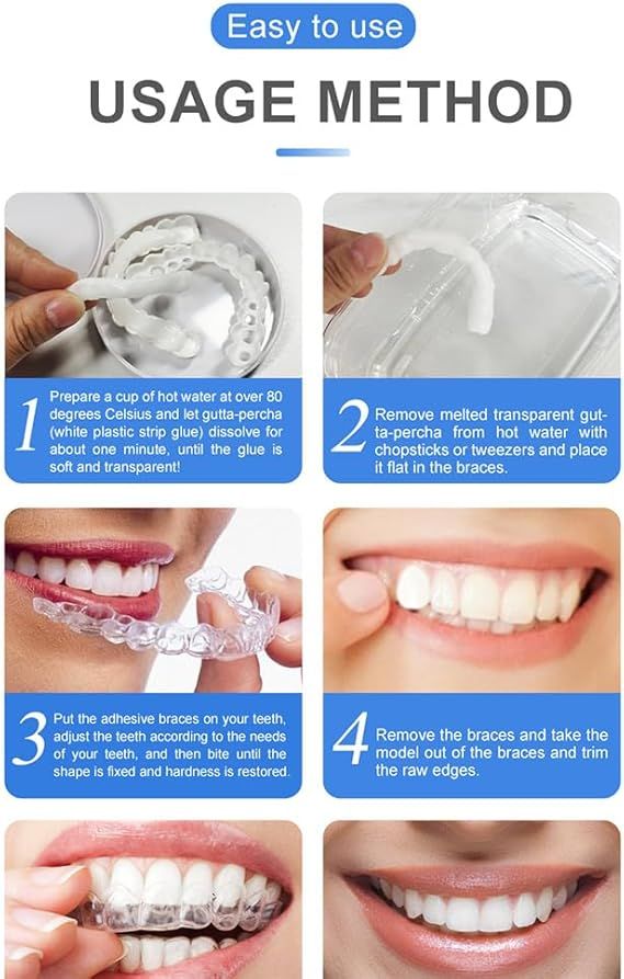Instant Smile Snap-On Veneers