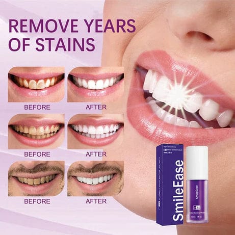 Teeth Whitening with Hismile V34 – 30ml Color Corrector Serum for Brighter Smile