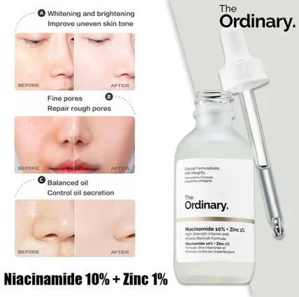 🔥 The Ordinary Niacinamide 10% + Zinc 1% Serum – Supersize 30ml | Oil Control & Skin Brightening Formula 🚀