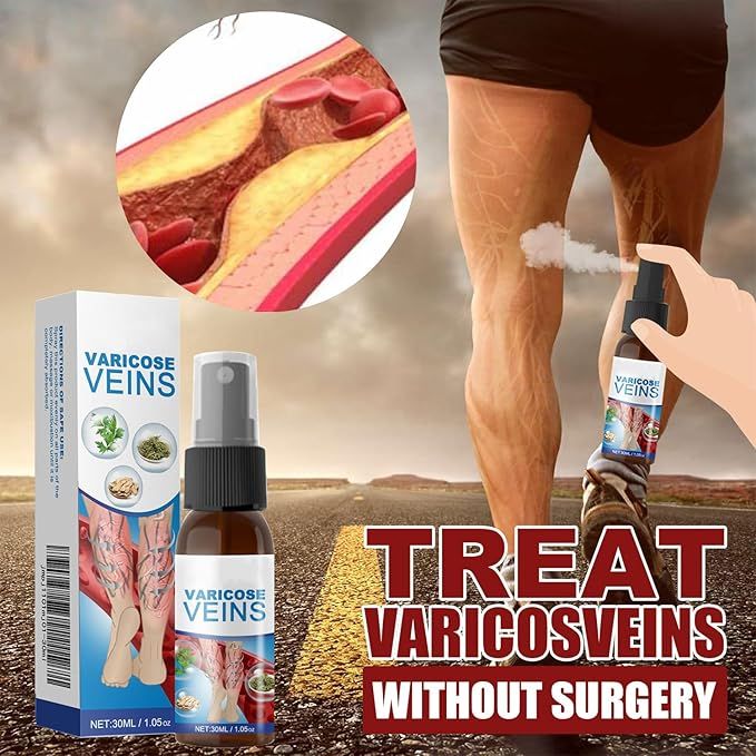 Vein Healing Varicose Veins Treatment Spray – Cooling Soothing Leg Relief & Skin Care Spray